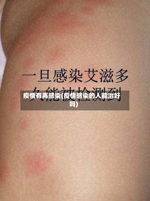 疫情有再感染(疫情感染的人能治好吗)-第3张图片