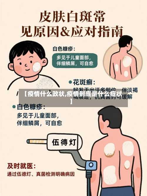 【疫情什么政状,疫情到底是什么症状】