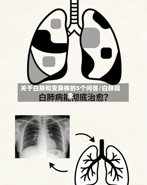 关于白肺和变异株的5个问答/白肺现象