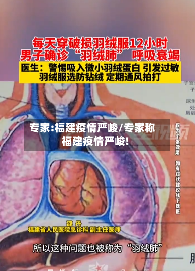 专家:福建疫情严峻/专家称福建疫情严峻!