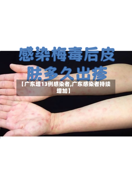 【广东增13例感染者,广东感染者持续增加】