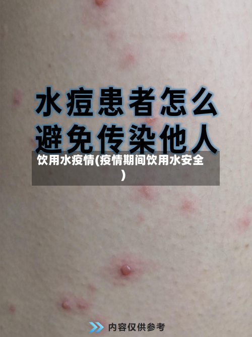 饮用水疫情(疫情期间饮用水安全)