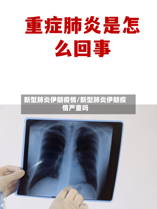 新型肺炎伊朗疫情/新型肺炎伊朗疫情严重吗-第2张图片