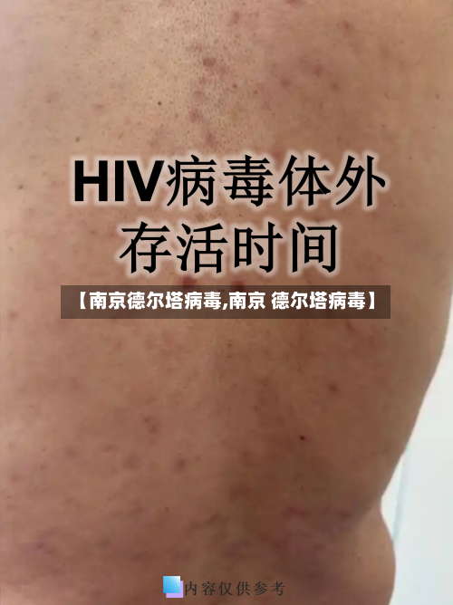 【南京德尔塔病毒,南京 德尔塔病毒】-第2张图片
