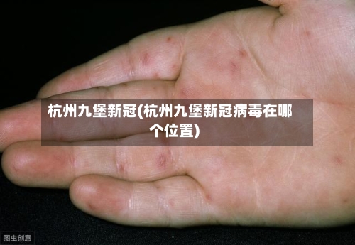 杭州九堡新冠(杭州九堡新冠病毒在哪个位置)-第2张图片