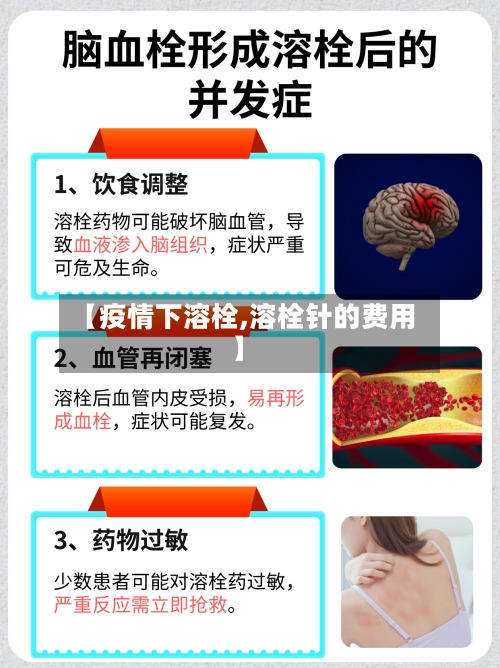 【疫情下溶栓,溶栓针的费用】
