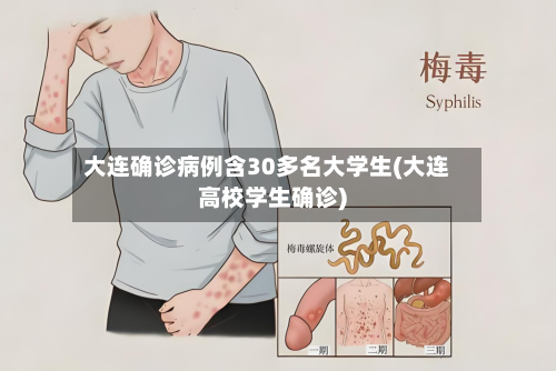 大连确诊病例含30多名大学生(大连高校学生确诊)