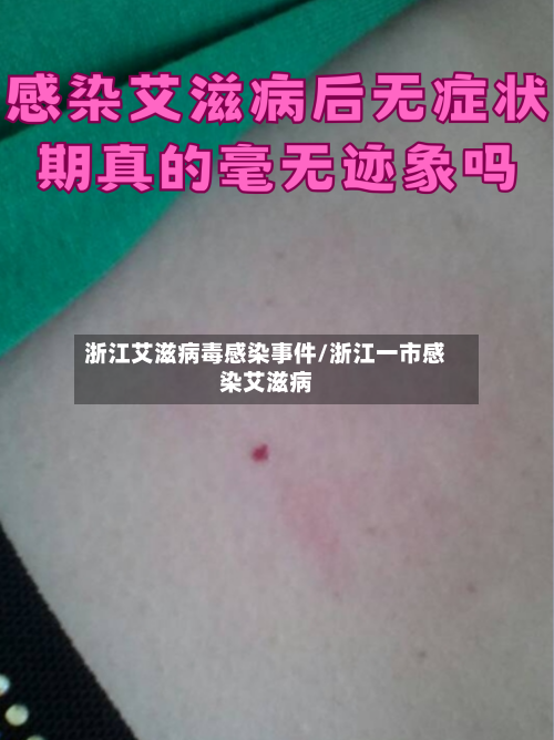 浙江艾滋病毒感染事件/浙江一市感染艾滋病