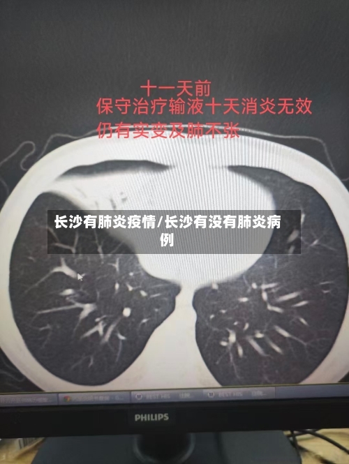 长沙有肺炎疫情/长沙有没有肺炎病例-第3张图片