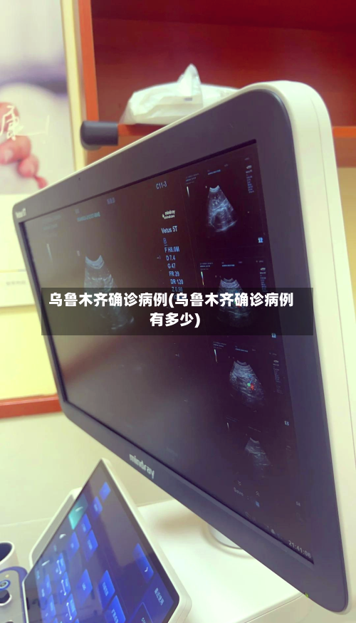 乌鲁木齐确诊病例(乌鲁木齐确诊病例有多少)-第2张图片